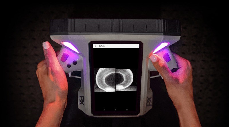 Powerful Handheld Backscatter X-ray Imager Launched