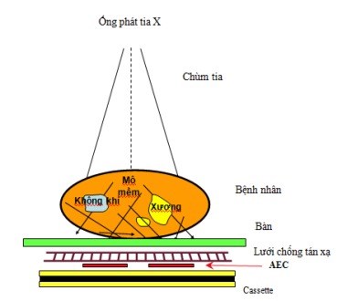 Máy X-Ray hoạt động như thế nào?